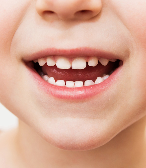 closeup of a child's smile